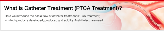 What is Catheter Treatment (PTCA Treatment)?